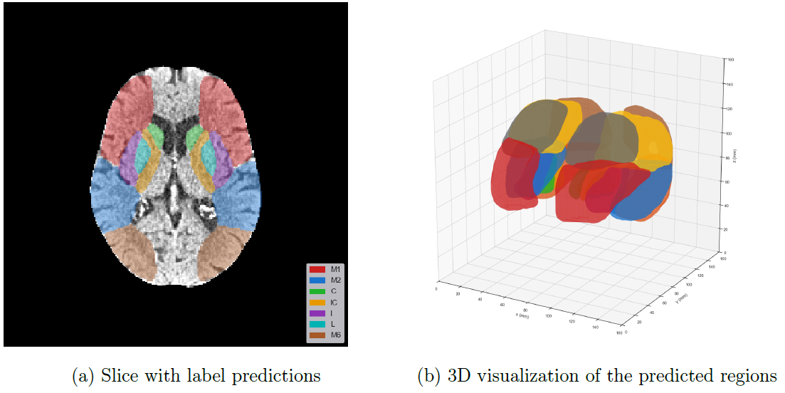Prediction Visualization